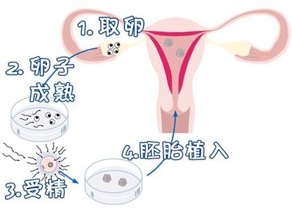 测序平台